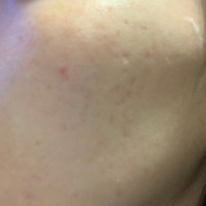 キールズ　クリーム-UFC